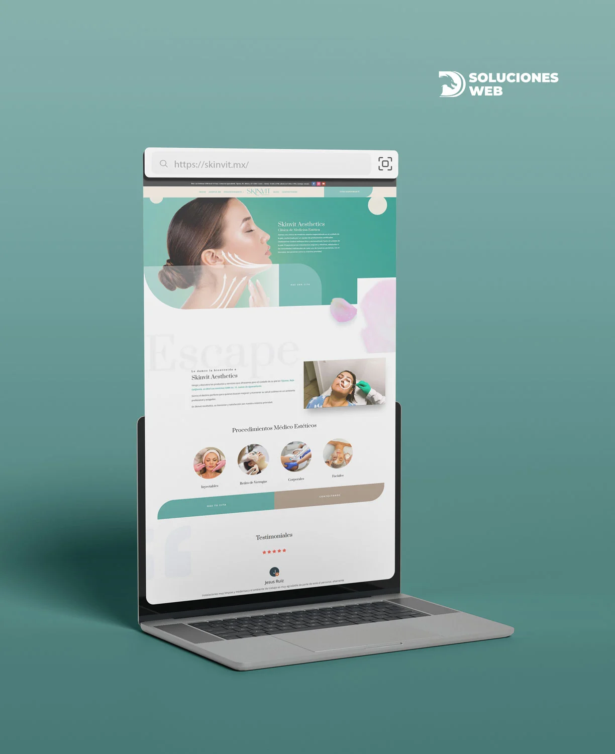 Pagina Web Tijuana Cliente Skinvit Aesthetics